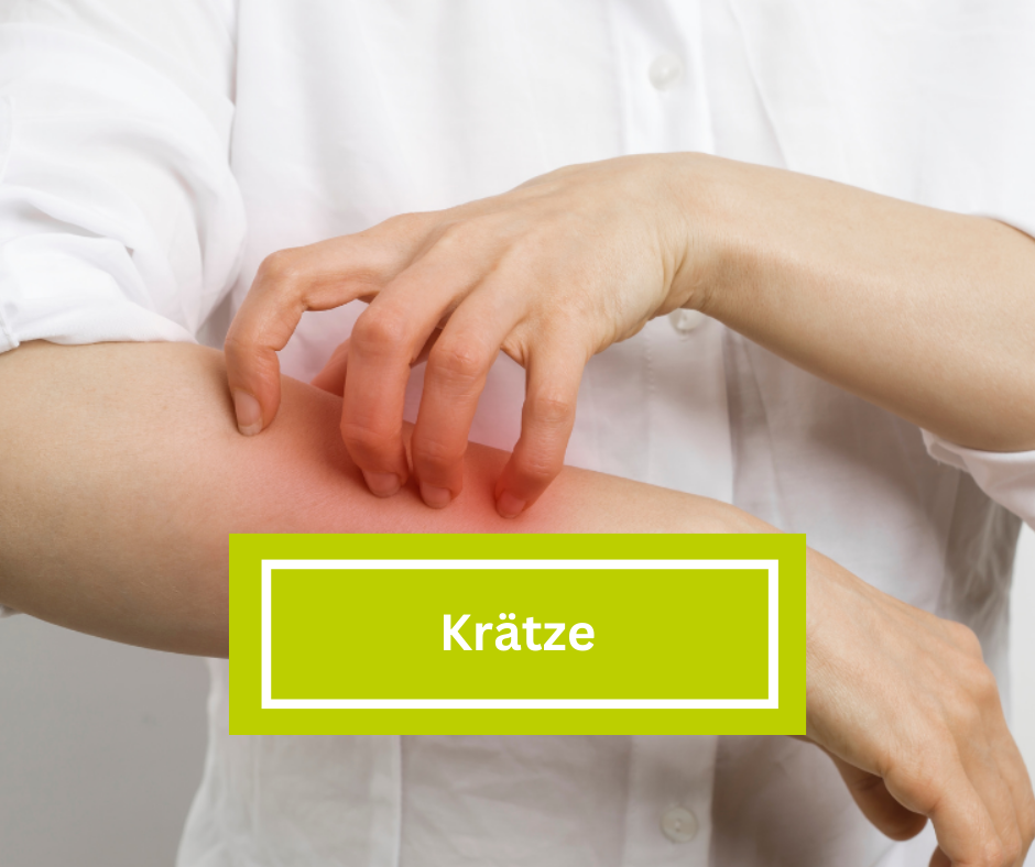 Krätze Geht Nicht Weg Krankenhaus